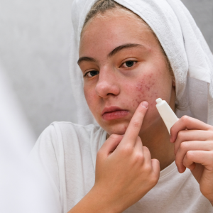 Tratamentos estéticos