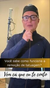 como funciona a remoção de tatuagem